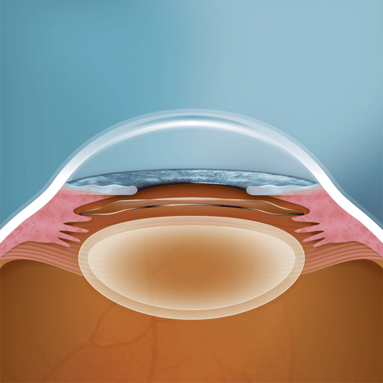 術後の定期検査